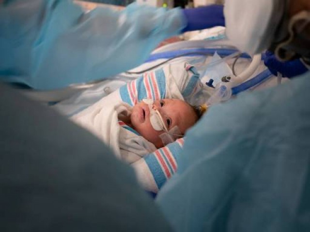 Internações de crianças nos EUA aumentaram com variante Delta