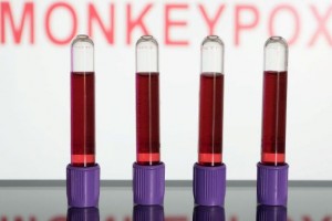 VarÃola dos macacos: entenda a transmissão, os sintomas e a vacina | Foto: Agência Brasil