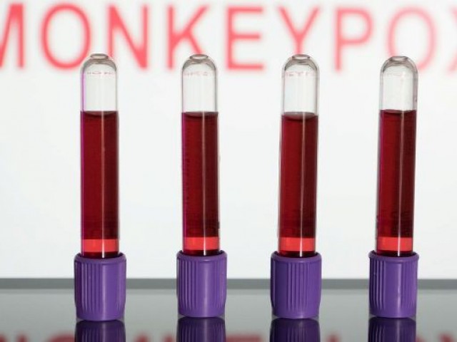 Varíola dos macacos: entenda a transmissão, os sintomas e a vacina